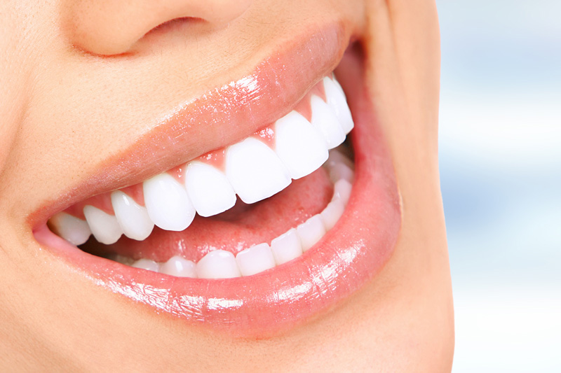 Cosmetic Dentistry in Alhambra