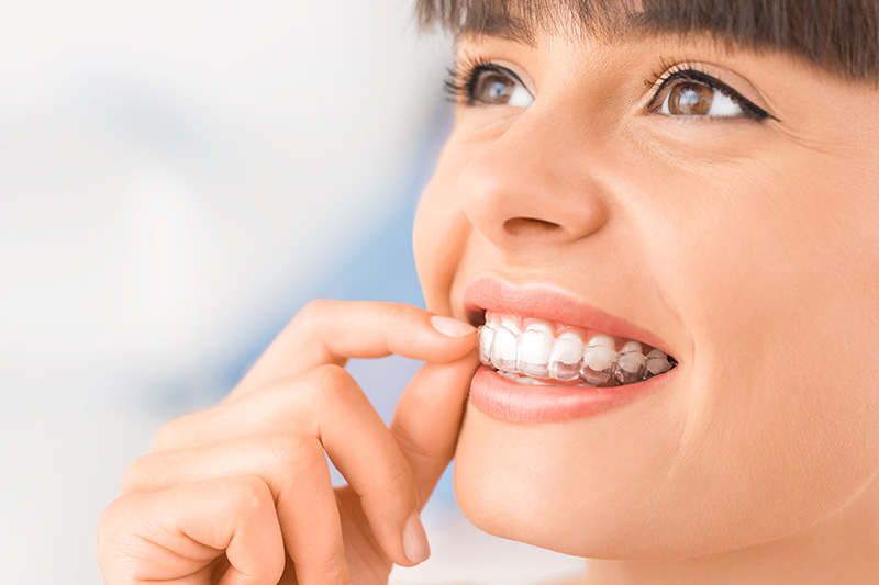 Quality Dental Treatments in Alhambra